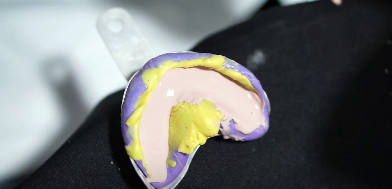 Auxiliar de prótese dentária vazando gesso